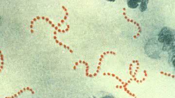 Imagem mostrando estreptococos em um nível microscópico - Divulgação/ Domínio Público