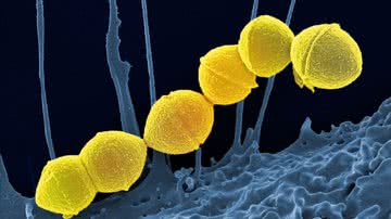 Streptococcus pyogenes - Wikimedia Commons/NIAID