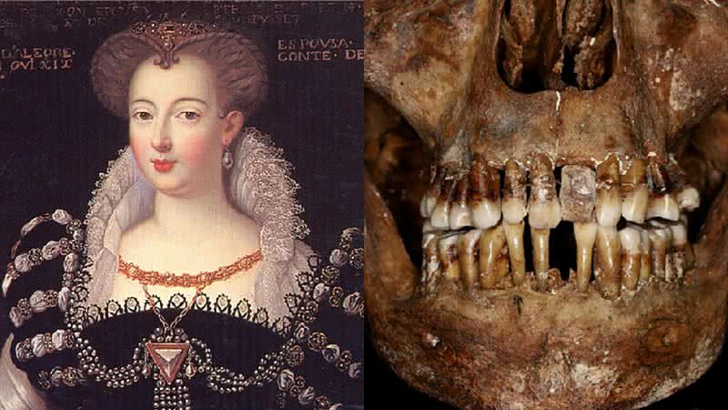 Dentes da aristocrata Anne d'Alègre foram analisados em estudo em 2023 - Divulgação/Journal of Archaeological Science: Rozenn Colleter, INRAP