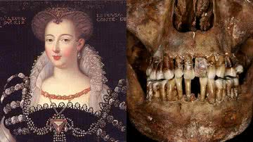 Dentes da aristocrata Anne d'Alègre foram analisados em estudo em 2023 - Divulgação/Journal of Archaeological Science: Rozenn Colleter, INRAP