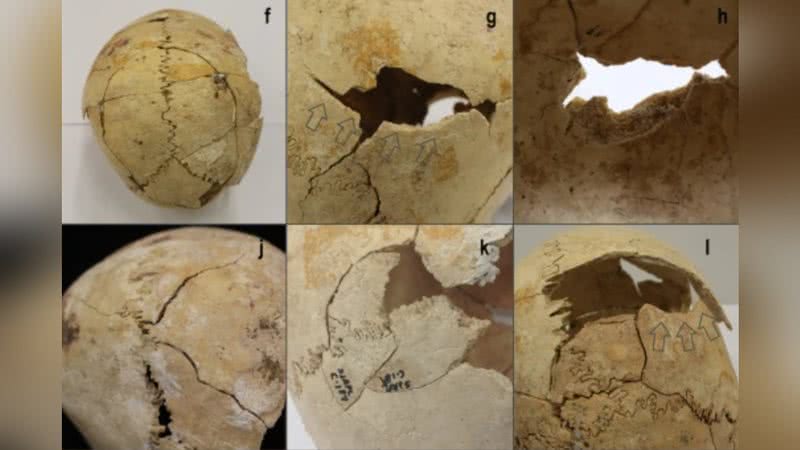 Imagens de crânios fraturados encontrados em sítio arqueológico na Espanha - Divulgação/Science Reports/Férnandez-Crespo et al.