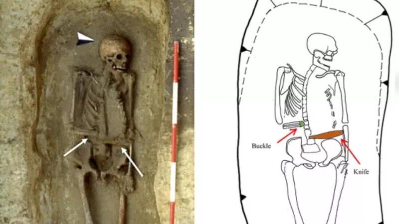 O esqueleto do homem com uma faca no lugar da mão - Divulgação/Micarelli et al./Journal of Anthropological Sciences