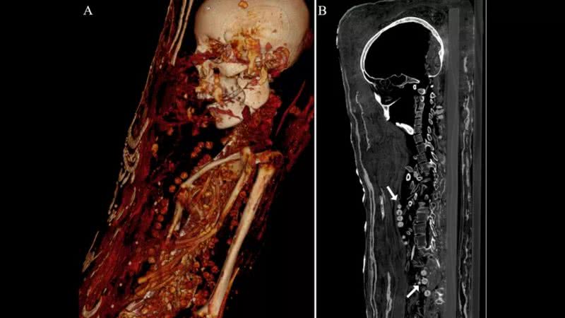 Tomografias computadorizadas das múmias egípcias - Divulgação - PLOS One