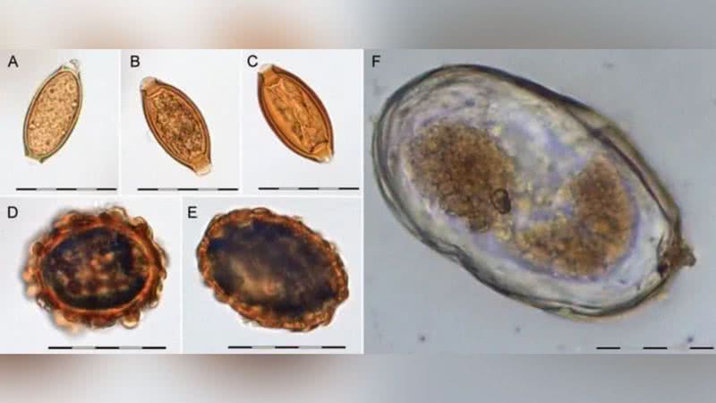 Imagem microscópica captura amostra de ovo de parasita - Divulgação / University of Copenhagen