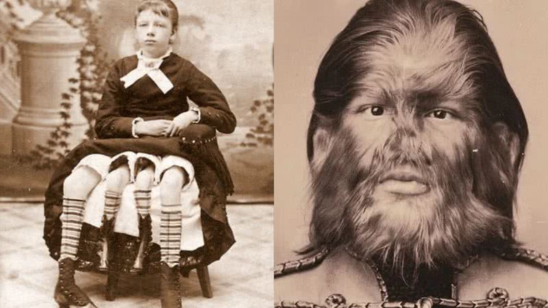 Fotografias de Myrtle Corbin e Fedor Jeftichew, respectivamente - Divulgação