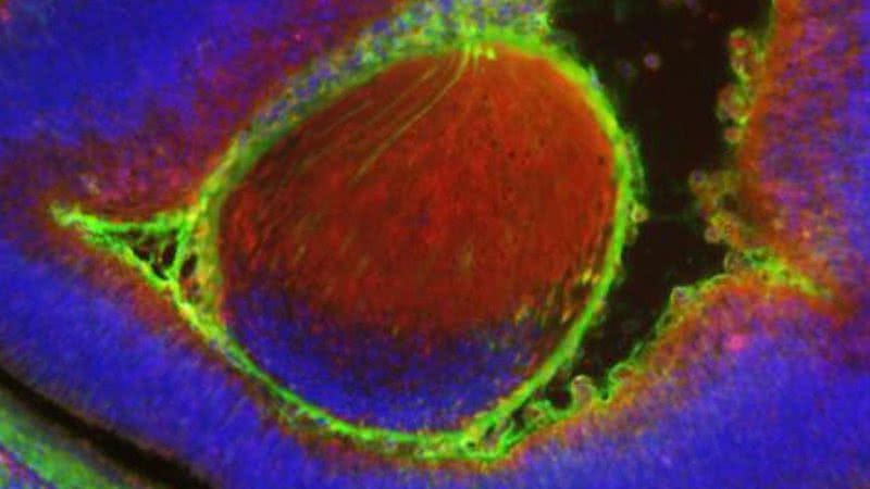 Embrião de rato com células humanas visto na microscopia - Divulgação/ Universidade Estadual de Nova York