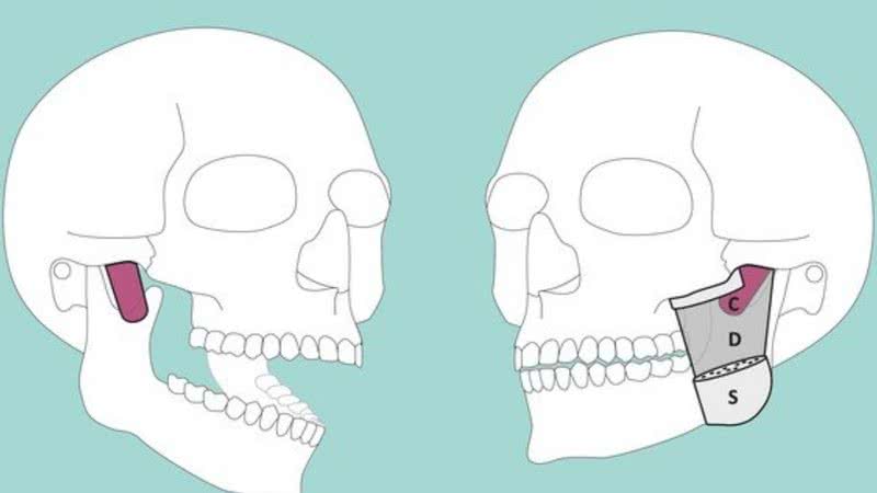 Ilustração da parte do corpo humano recém-descoberta - Divulgação/Jens. C. Türp, University of Basel / UZB