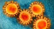 uploads/coronavirus_laboratorio.jpg - uploads/coronavirus_laboratorio.jpg