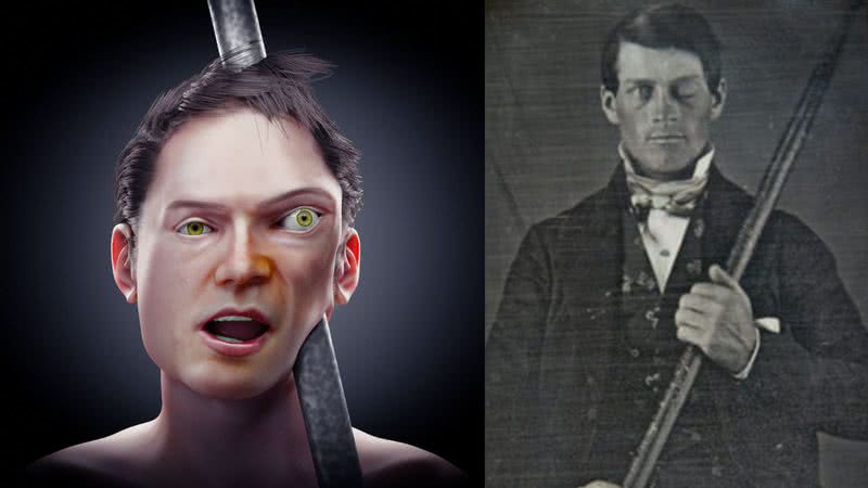 Montagem mostrando modelo 3D e fotografia de Phineas Gage - Cícero Moraes e Domínio Público