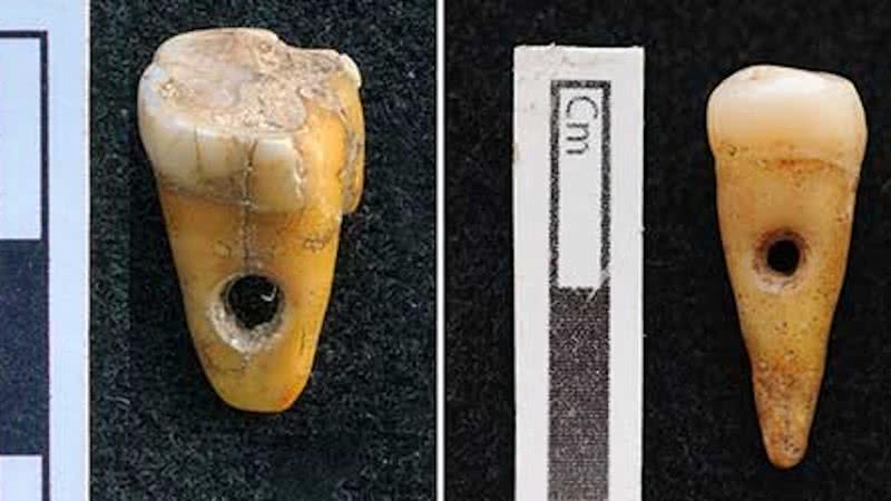 Os dois dentes encontrados em Çatalhöyük - Universidade de Copenhagen