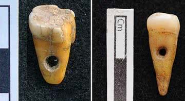 Os dois dentes encontrados em Çatalhöyük - Universidade de Copenhagen