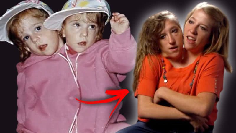 Montagem de Abby e Brittany na infância e em foto recente - Divulgação / Vídeo / OWN