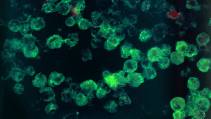 Detalhes da ameba Naegleria fowleri, conhecida como 'comedora de cérebros' - Divulgação/CDC