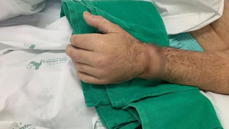 O homem teve a mão reimplantada - Divulgação/Hospital Santo Antônio