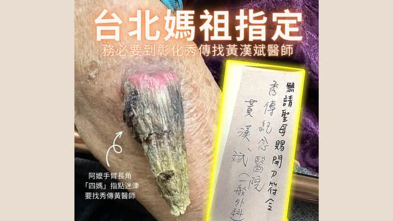 Postagem de médico sobre o caso da mulher de Taiwan - Divulgação/Facebook: 黃漢斌醫師 /「斌」紛外科視角