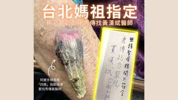 Postagem de médico sobre o caso da mulher de Taiwan - Divulgação/Facebook: 黃漢斌醫師 /「斌」紛外科視角