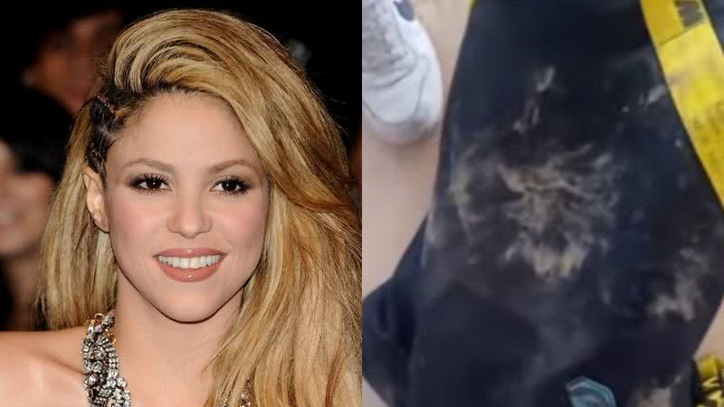 Montagem de Shakira ao lado de sua mochila, após ataque de javalis - Getty Images / Divulgação/Instagram/@shakira