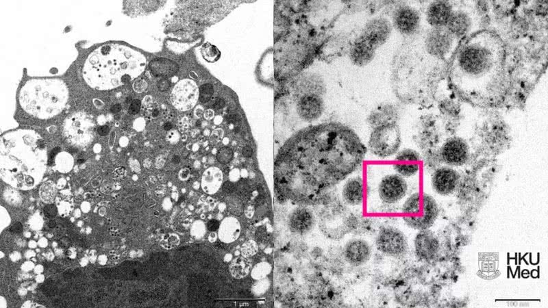 Imagem microscópica captura amostra da ômicron - Divulgação / Faculdade de Medicina da Universidade de Hong Kong