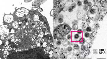 Imagem microscópica captura amostra da ômicron - Divulgação / Faculdade de Medicina da Universidade de Hong Kong