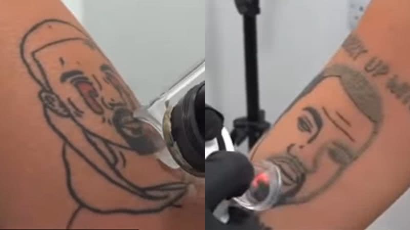 Trechos de vídeos com tatuagens com Kanye West estampado sendo removidas - Reprodução/Vídeo/Instagram @naamastudios