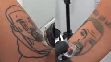 Trechos de vídeos com tatuagens com Kanye West estampado sendo removidas - Reprodução/Vídeo/Instagram @naamastudios