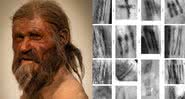 Ötzi, o homem do gelo e suas tatagens - Wikimedia Commons - EURAC / M.Samadelli / M.Melis