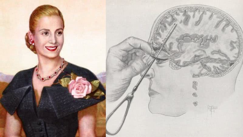 Montagem mostrando pintura de Eva Perón, e ilustração de lobotomia - Domínio Público