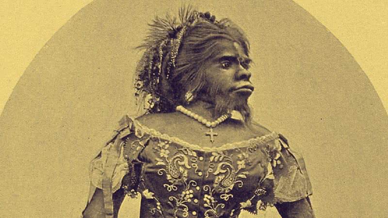 Julia Pastrana, a Mulher Macaco - Wikimedia Commons