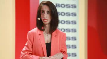 A ativista Lizzie Velásquez - Getty Images