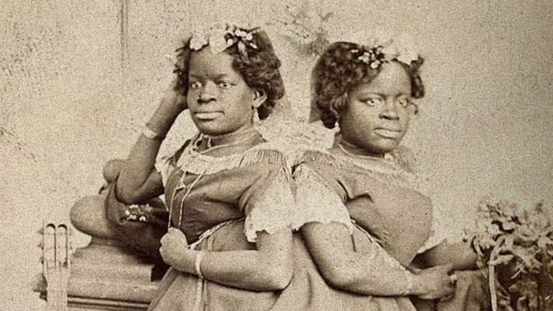 Wikimedia Commons - Millie e Christine McKoy