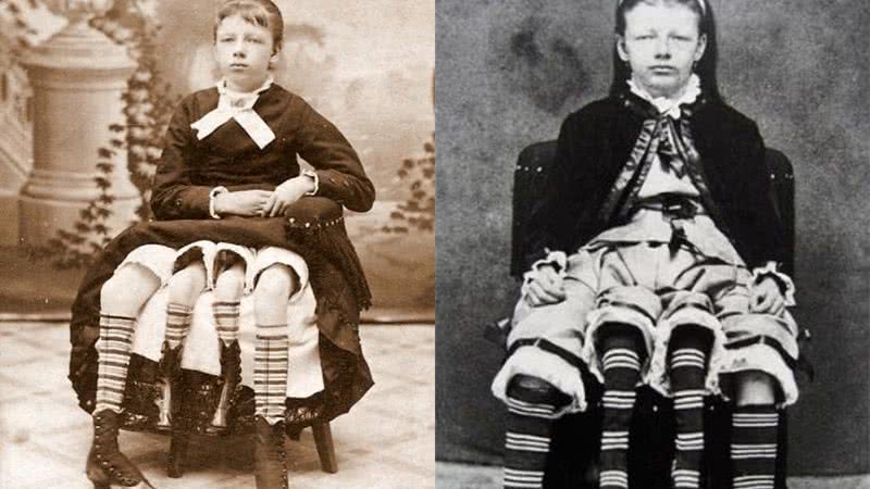 Josephine Myrtle Corbin, a mulher de quatro pernas - Divulgação