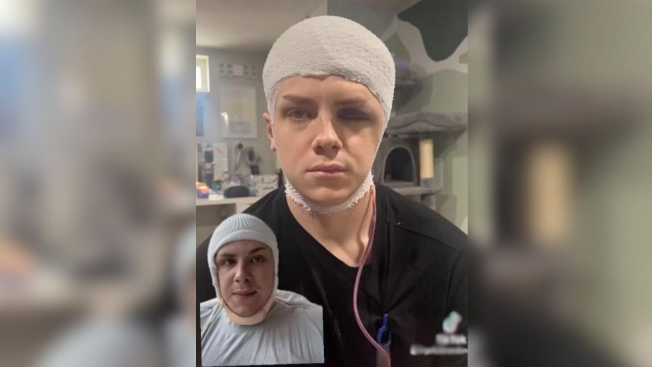 Paciente tem parte de crânio removida para realização de ‘lavagem cerebral’