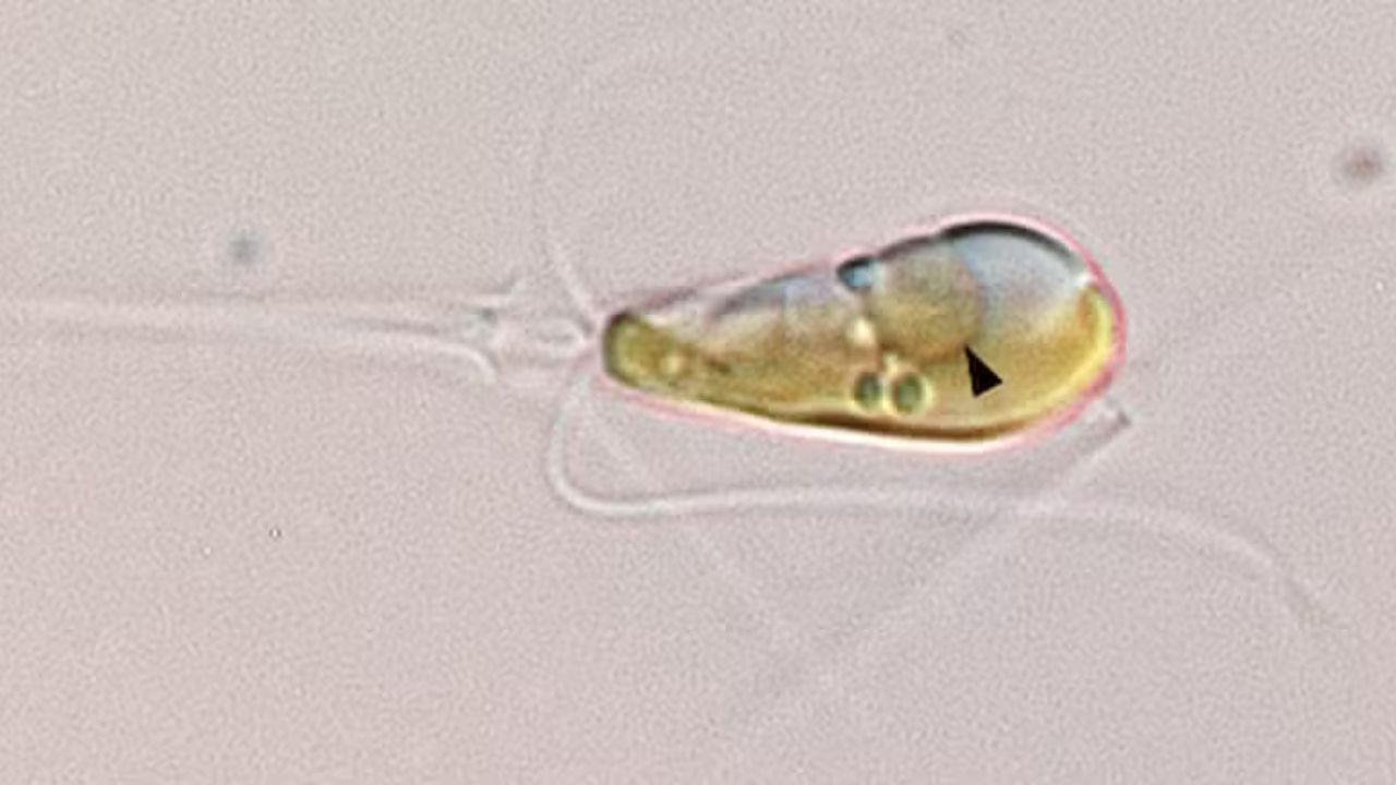 Fenômeno raro envolvendo célula eucariótica é descoberto por cientistas