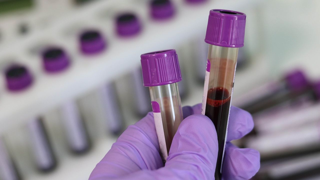 Reino Unido indenizará pessoas que receberam transfusão de sangue contaminado com HIV