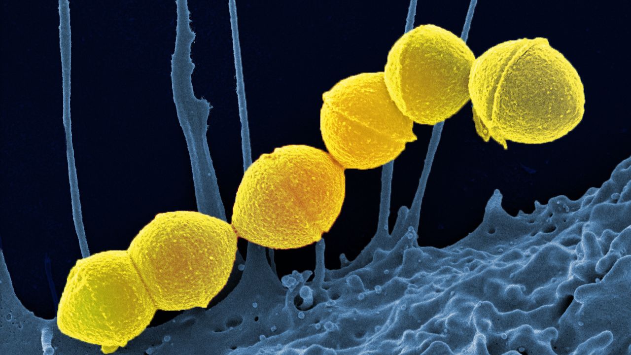 Japão já registrou mais de mil casos de infecções por bactéria comedora de carne este ano