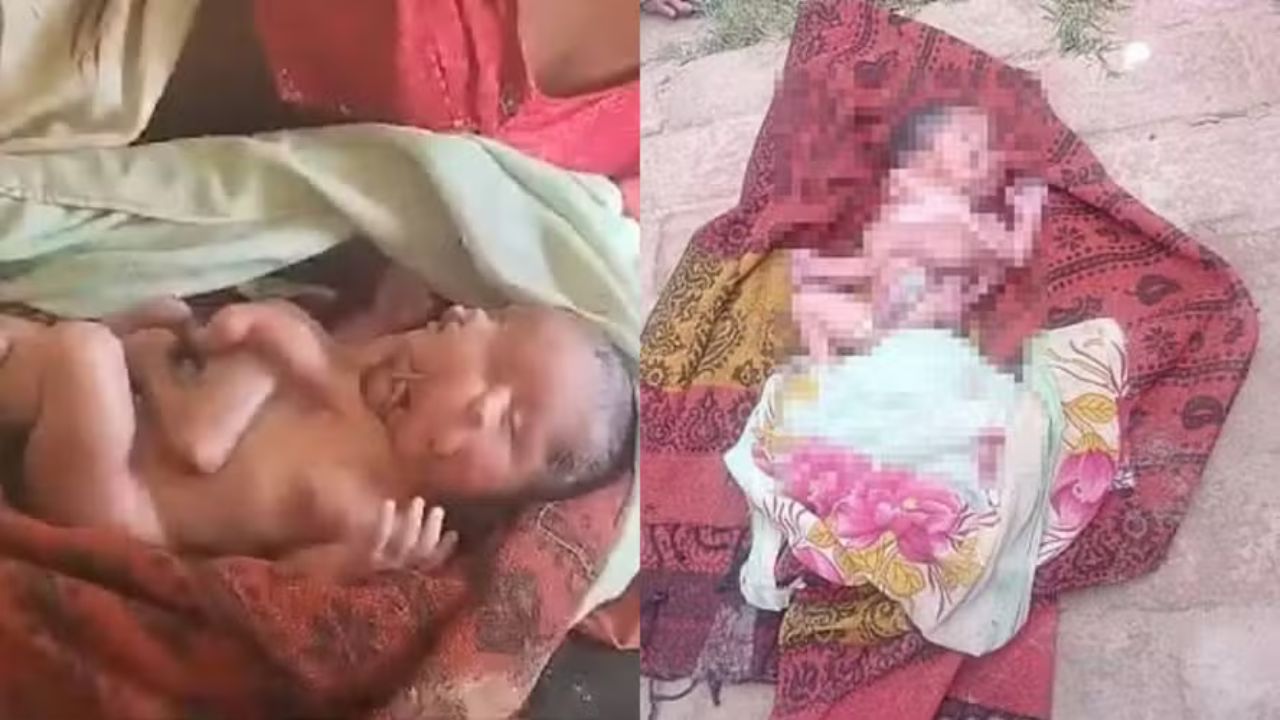 Índia: Bebê nasce com quatro pernas, quatro braços e dois rostos