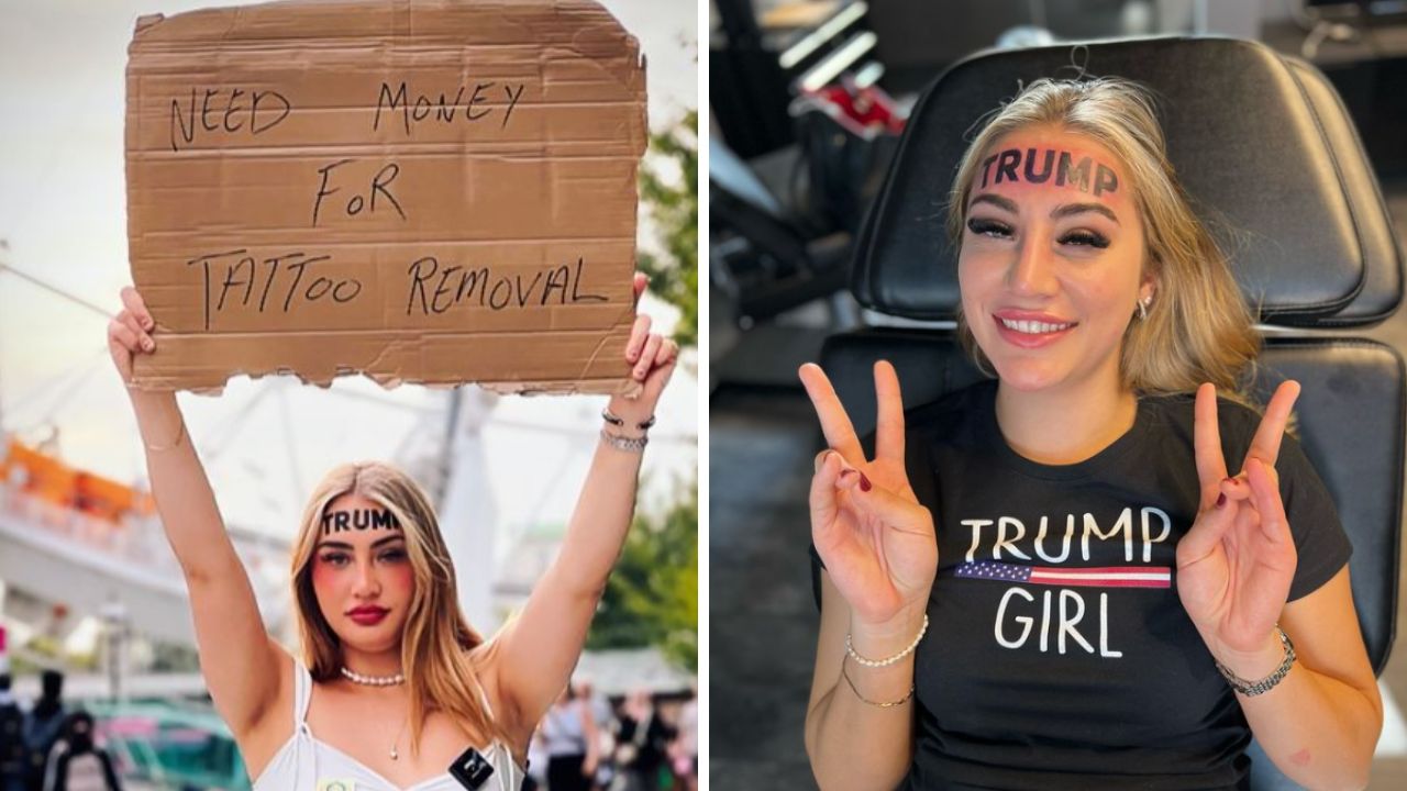 Mulher que tatuou ‘Trump’ na testa pede ajuda financeira para remoção