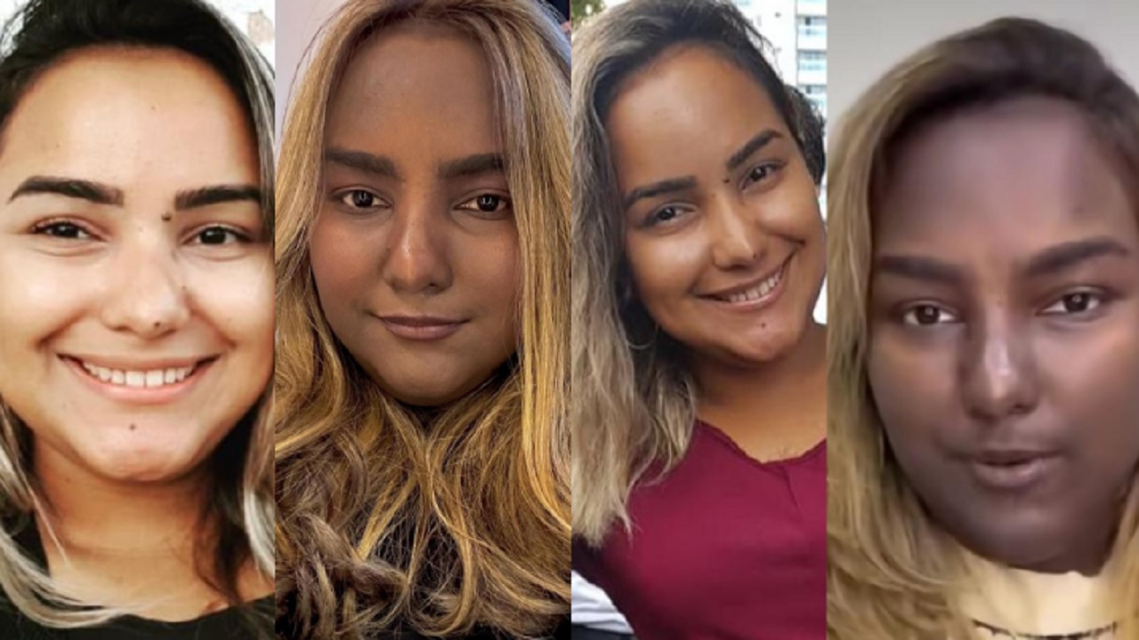 Jovem cearense sofre com doença rara que faz pele mudar de cor