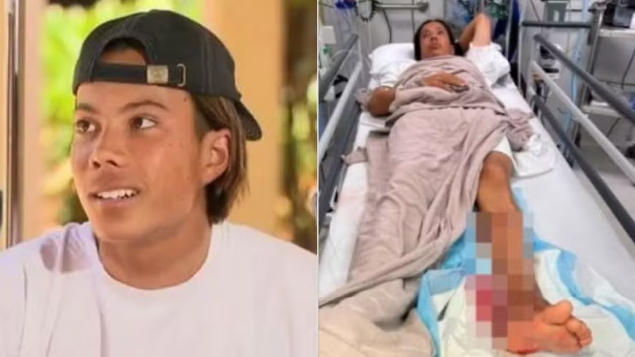Susto na Austrália: surfista é atacado por tubarão em praia