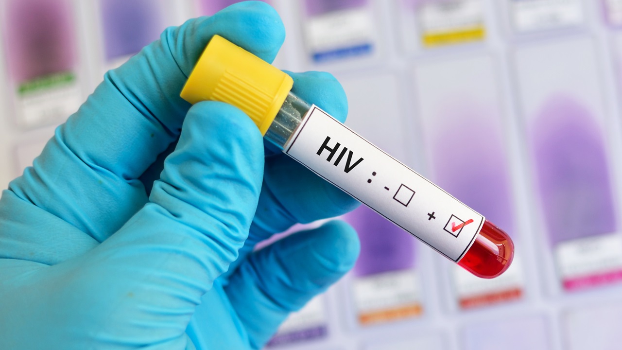 Alerta: Infecções por HIV podem aumentar após fim de apoio dos EUA