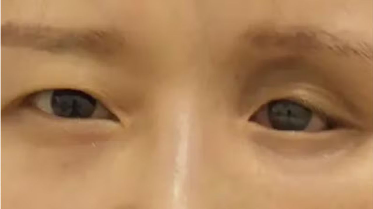 A inusitada descoberta da chinesa que se consultou com cirurgião plástico