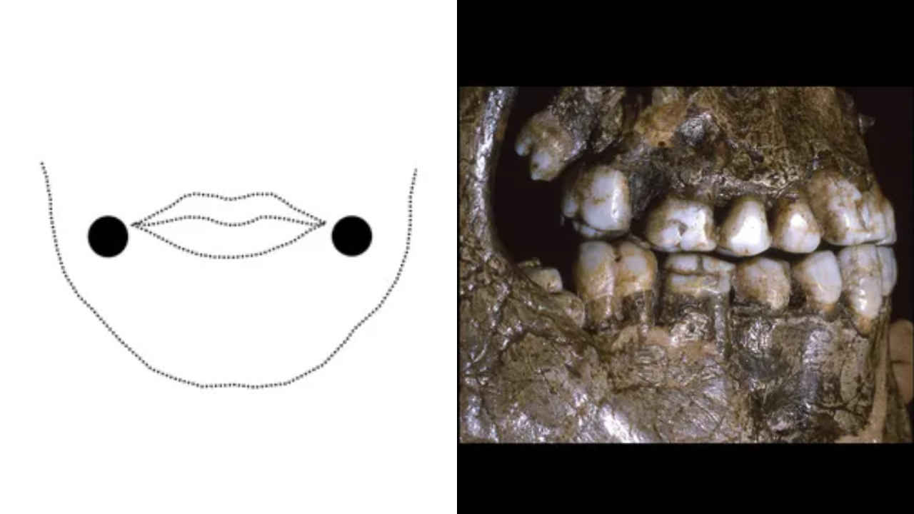 Jovens que viveram na Era Glacial usavam ‘piercings’ nas bochechas