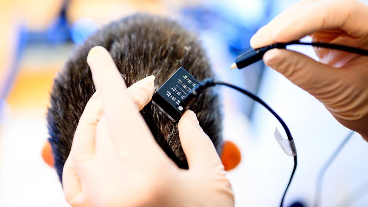 Implante cerebral transforma pensamentos em palavras em tempo real