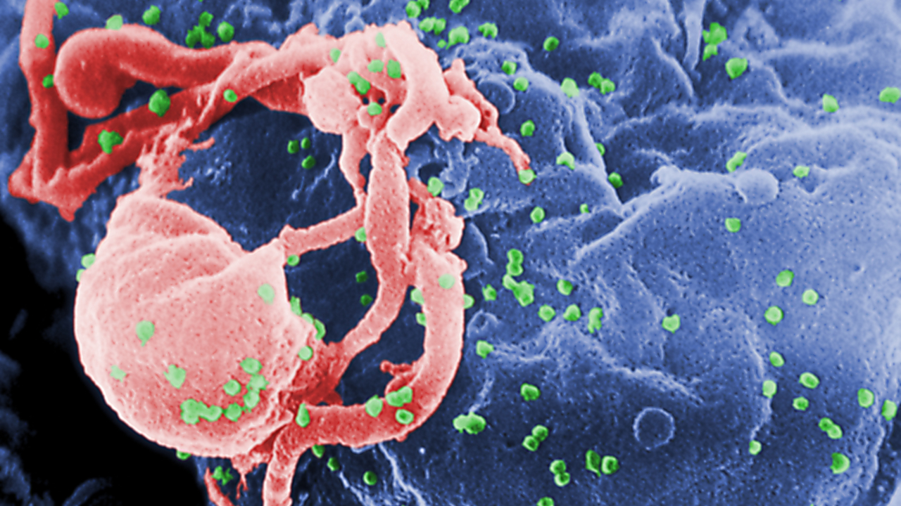 Mutação que combate o HIV surgiu há 9.000 anos, perto do Mar Negro