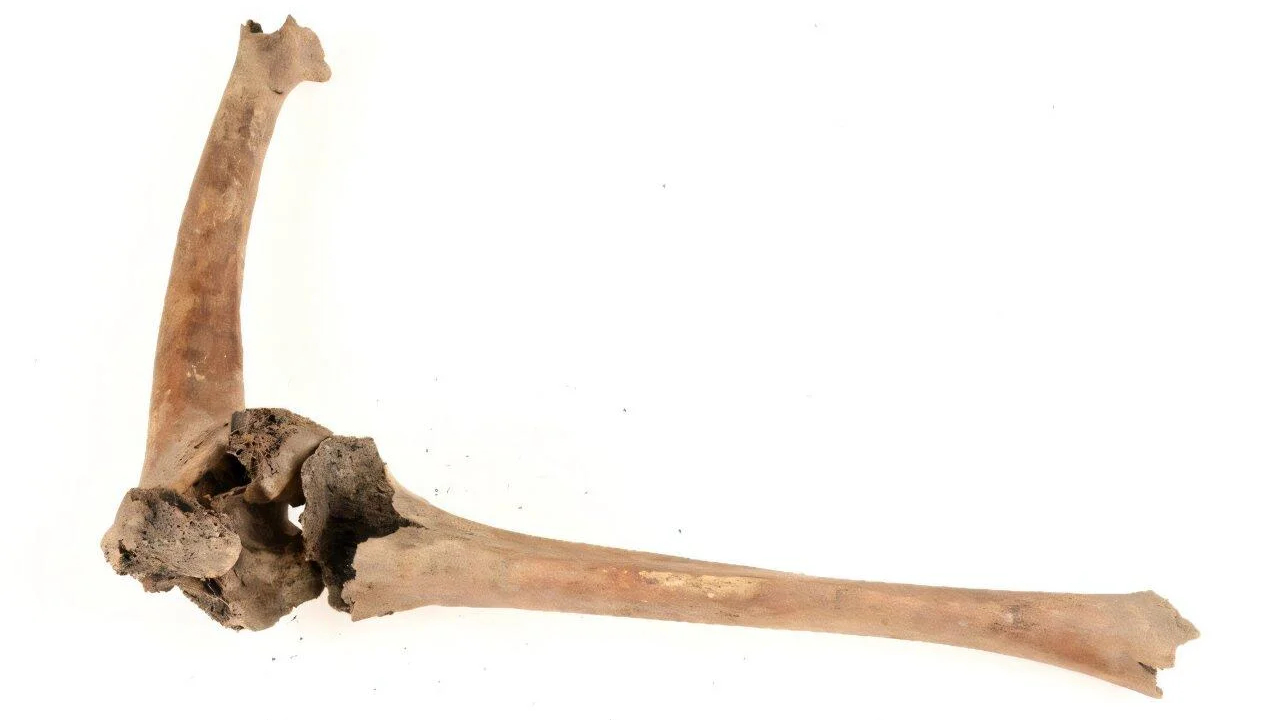 Joelho de homem aleijado revela cuidados para deficientes na Suécia medieval
