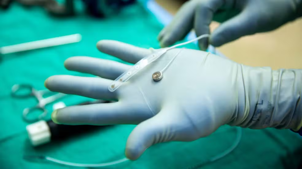 Empresa rival de Musk testa primeiro implante de chip cerebral em humano