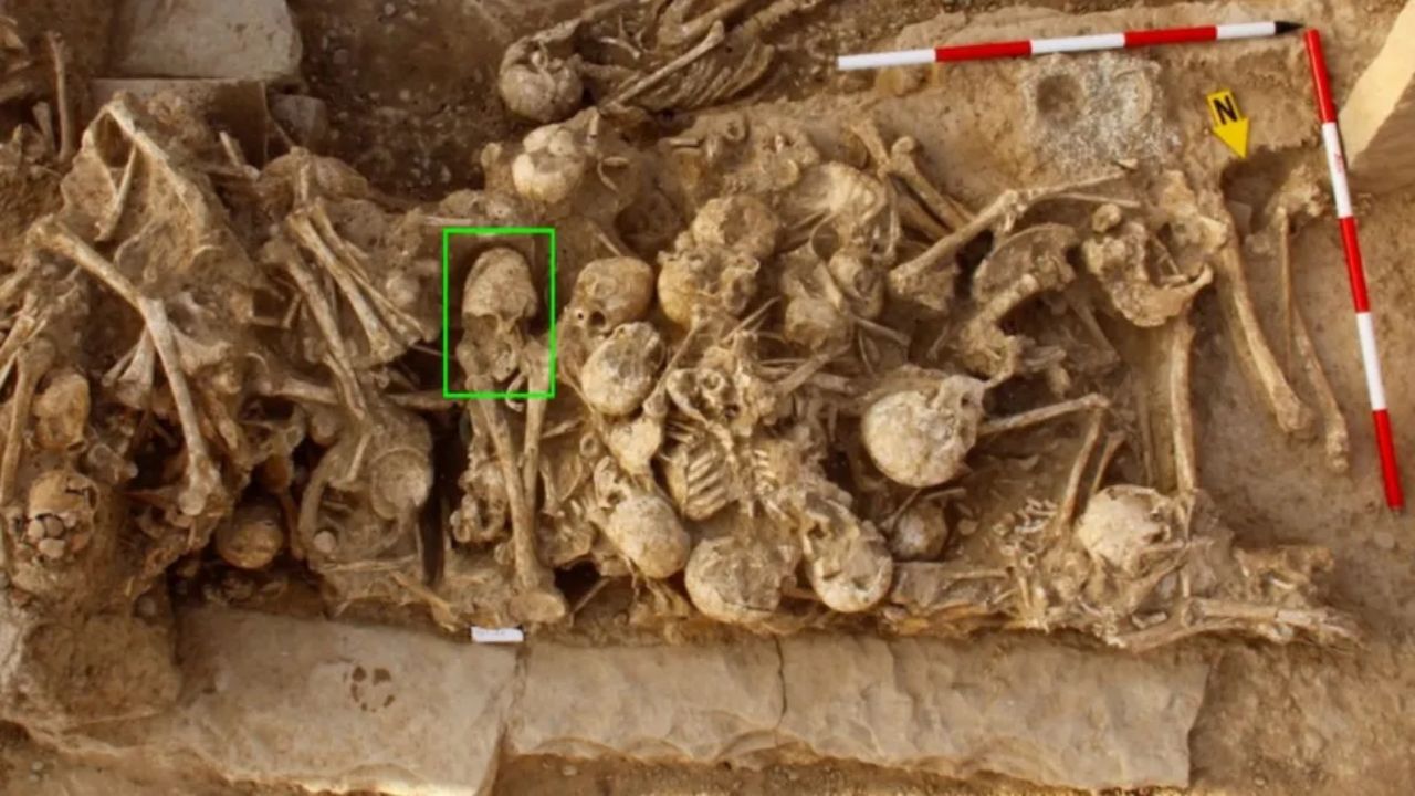 Crânio com formato curioso encontrado no Irã foi misteriosamente esmagado