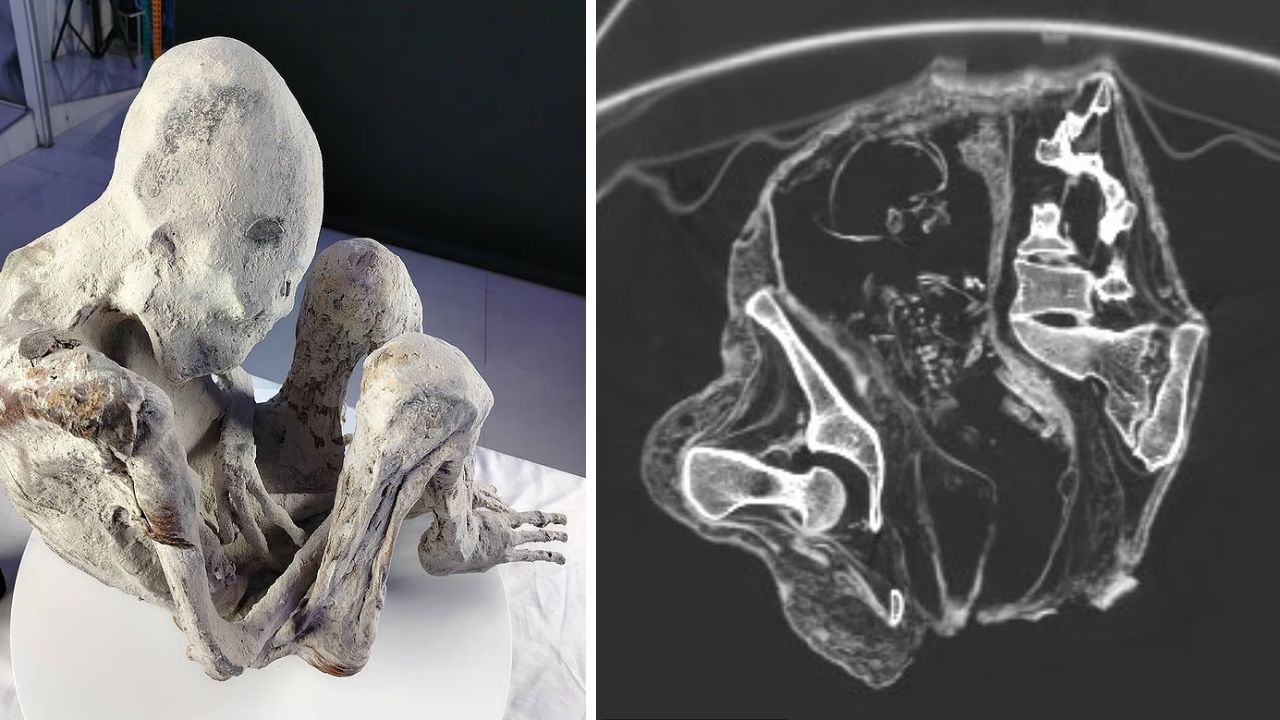 Pesquisadores encontram suposto feto em múmia ‘alienígena’ do Peru