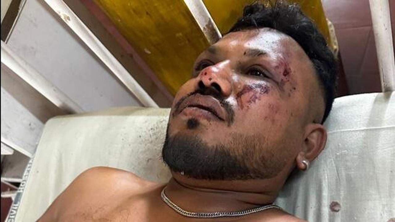 Sobrevivente de tragédia aérea na Índia desafia duas estatísticas