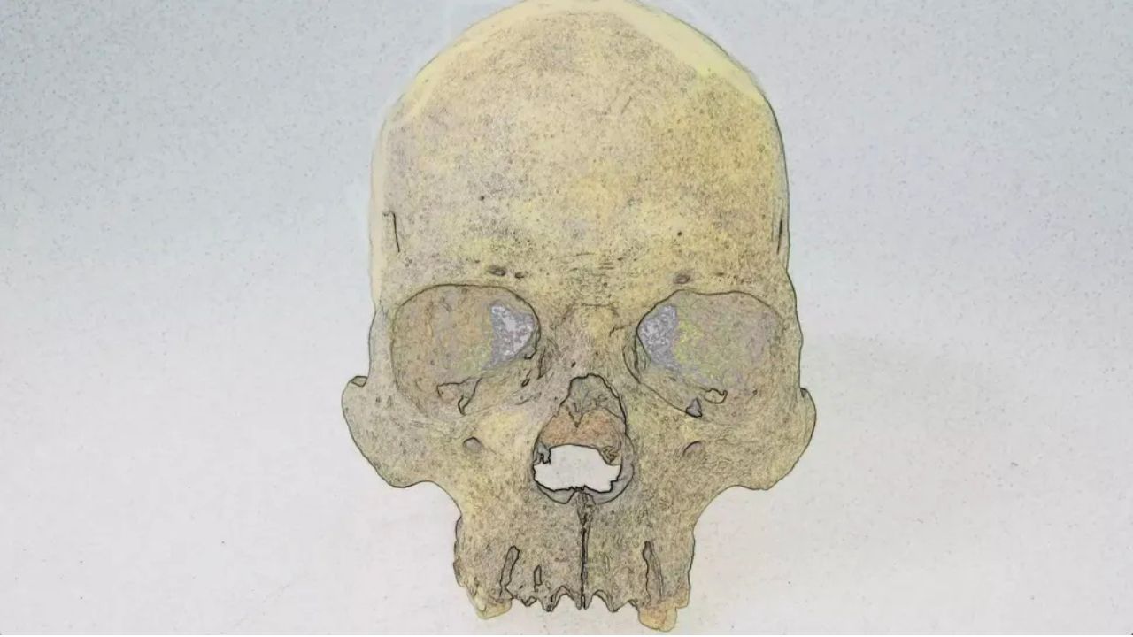 Forma rara de hanseníase já existia nas Américas há 4 mil anos, indica estudo